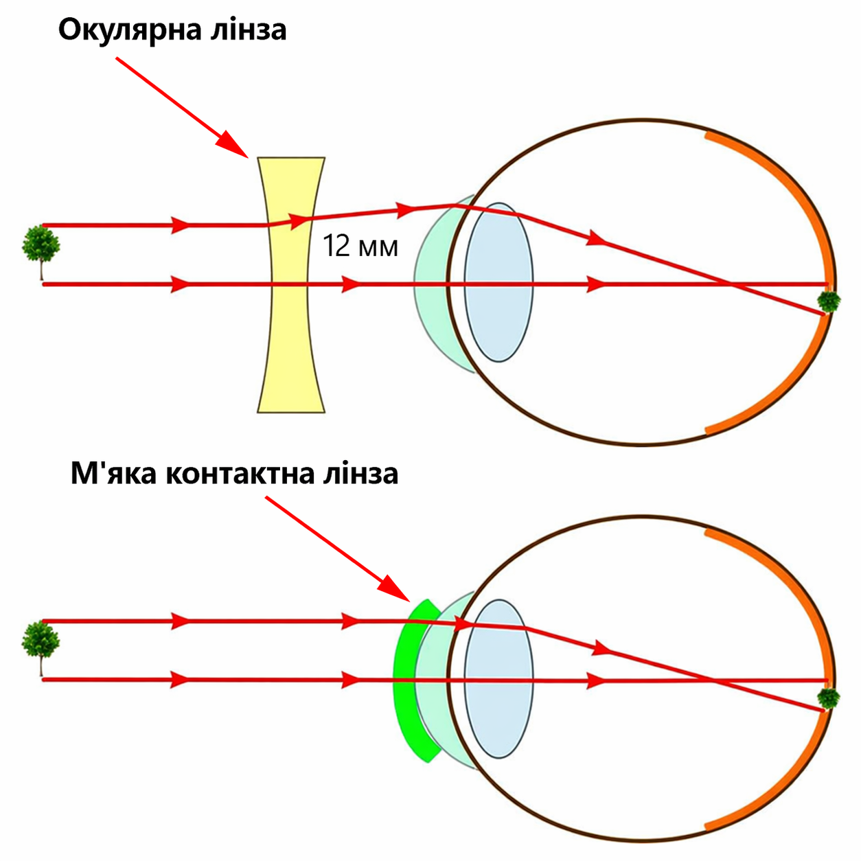 Як фокусуються лінзи на оці